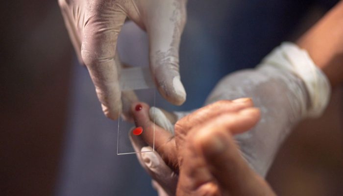 © TV Brasil/Reprodução