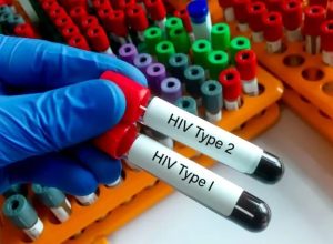 Mulher morre após diagnóstico de HIV, e família denuncia suspeita de homem por transmissão intencional