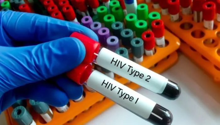Mulher morre após diagnóstico de HIV, e família denuncia suspeita de homem por transmissão intencional